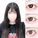 アリエルクイックループトリプル二重埋没法/涙袋ヒアルロン酸 90日後 サムネイル用