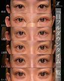 目フルの実力 180日後 サムネイル用