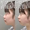 【ツンとした鼻先へ👃】 after画像 サムネイル用