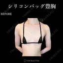 シリコンバッグ豊胸💎麻酔代込み before画像 サムネイル用