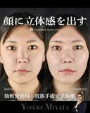 立体的な顔に 150日後 サムネイル用