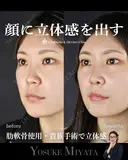 立体的な顔に 150日後 サムネイル用