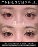 タレ目を含む目フル before画像 サムネイル用