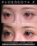 タレ目を含む目フル 30日後 サムネイル用