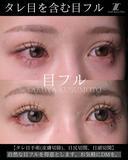 タレ目を含む目フル 30日後 サムネイル用