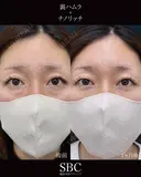 裏ハムラ・ナノリッチ before画像 サムネイル用