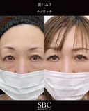 裏ハムラ・ナノリッチ after画像 サムネイル用
