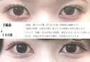 目頭切開 31日後 サムネイル用