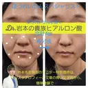 貴族ヒアルロン酸 0日後 サムネイル用