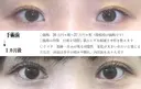 目頭切開 before画像 サムネイル用