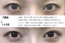 目頭切開 31日後 サムネイル用