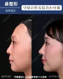 自然な垢抜けで可愛さアップデート 180日後 サムネイル用