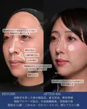 自然な垢抜けで可愛さアップデート 180日後 サムネイル用