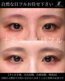 ナチュラル目フル 30日後 サムネイル用