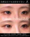 ナチュラル目フル 30日後 サムネイル用