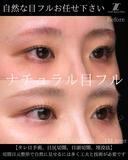 ナチュラル目フル 30日後 サムネイル用