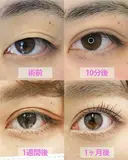 ✨クイックコスメティーク・ダブル✨ before画像 サムネイル用