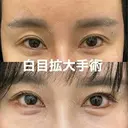 ✨魅力あふれる目✨の複合術 before画像 サムネイル用