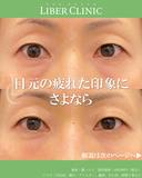 目元の疲れた印象にさよなら after画像 サムネイル用