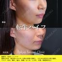 転生ハイフ 0日後 サムネイル用