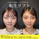 転生リフト before画像 サムネイル用