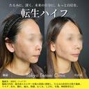 転生ハイフ after画像 サムネイル用