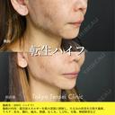 転生ハイフ before画像 サムネイル用