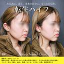 転生ハイフ before画像 サムネイル用