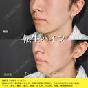 転生ハイフ after画像 サムネイル用