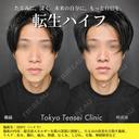 転生ハイフ before画像 サムネイル用