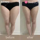 脂肪吸引 before画像 サムネイル用