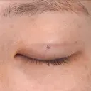 クイックコスメティーク・ダブル 7日後 サムネイル用