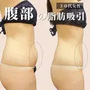 理想的なスッキリボディに😘 90日後 サムネイル用