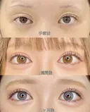 1dayルラライン before画像 サムネイル用