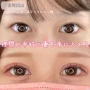 二重埋没法(エターナル法) after画像 サムネイル用