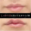 Cカールリップ 0日後 サムネイル用