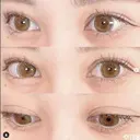 二重埋没法 before画像 サムネイル用