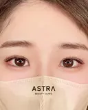【史上最高の二重へ】スターラインダブル after画像 サムネイル用