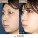人中短縮 before画像 サムネイル用