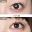 目頭切開 30日後 サムネイル用