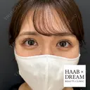 ドリームダブル after画像 サムネイル用