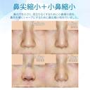 【20代女性・存在感のない「忘れ鼻」に】小鼻縮小術+α法 ＆ 鼻尖縮小術+α法（2年後） after画像 サムネイル用