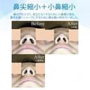 【20代女性・存在感のない「忘れ鼻」に】小鼻縮小術+α法 ＆ 鼻尖縮小術+α法（2年後） after画像 サムネイル用