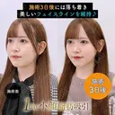 1day小顔®︎脂肪吸引（脂肪吸引（顔）＋糸リフト） 3日後 サムネイル用