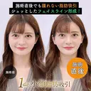 1day小顔®︎脂肪吸引（脂肪吸引（顔）＋糸リフト） before画像 サムネイル用