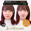 1day小顔®︎脂肪吸引（脂肪吸引（顔）＋糸リフト） 0日後 サムネイル用