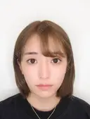 TAC式ツヤ肌コラーゲンリフト+バッカルファット除去 before画像 サムネイル用