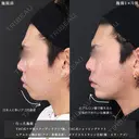 輪郭を整え、Sライン＆Eラインを作る😎 30日後 サムネイル用