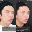 輪郭を整え、Sライン＆Eラインを作る😎 30日後 サムネイル用