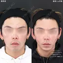 輪郭を整え、Sライン＆Eラインを作る😎 30日後 サムネイル用